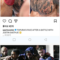 [혐오]극강 UFC 챔피언이었던 토푸리아 경기 후 상태