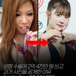 성형 수술에 2억 4천만원 쓰고 과거 사진 공개한 일본 인플루언서.jpg