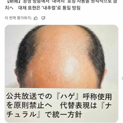 일본 대머리 근황
