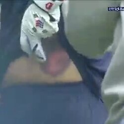 투수공 맞은 타자의 상태
