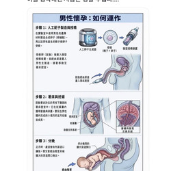 남성도 출산 가능하다.jpg